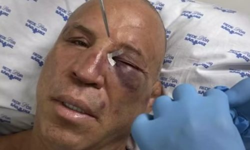 Wanderlei Silva quebra o nariz e leva pontos após confusão em luta contra Popó